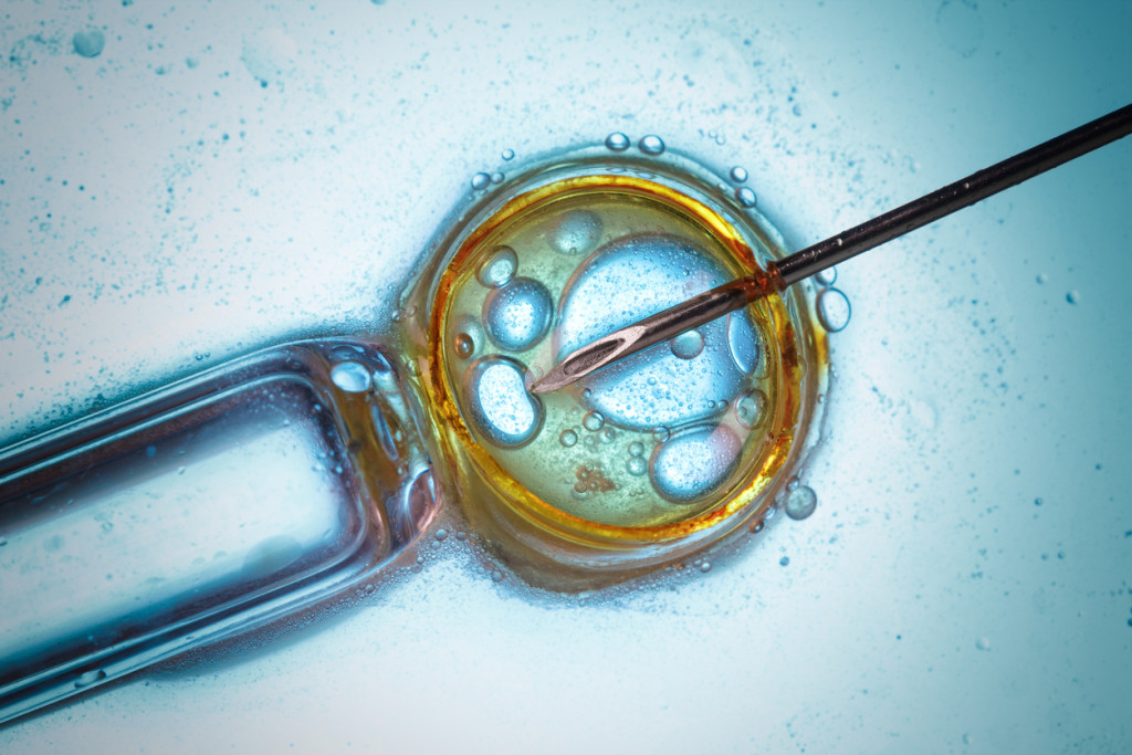 Infertility treatment and IVF