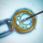 What Happens During an Embryo Transfer?
