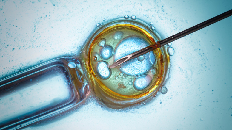 Infertility treatment and IVF