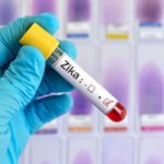 Zika Virus-Causes, Symptoms, Screening, and Treatments