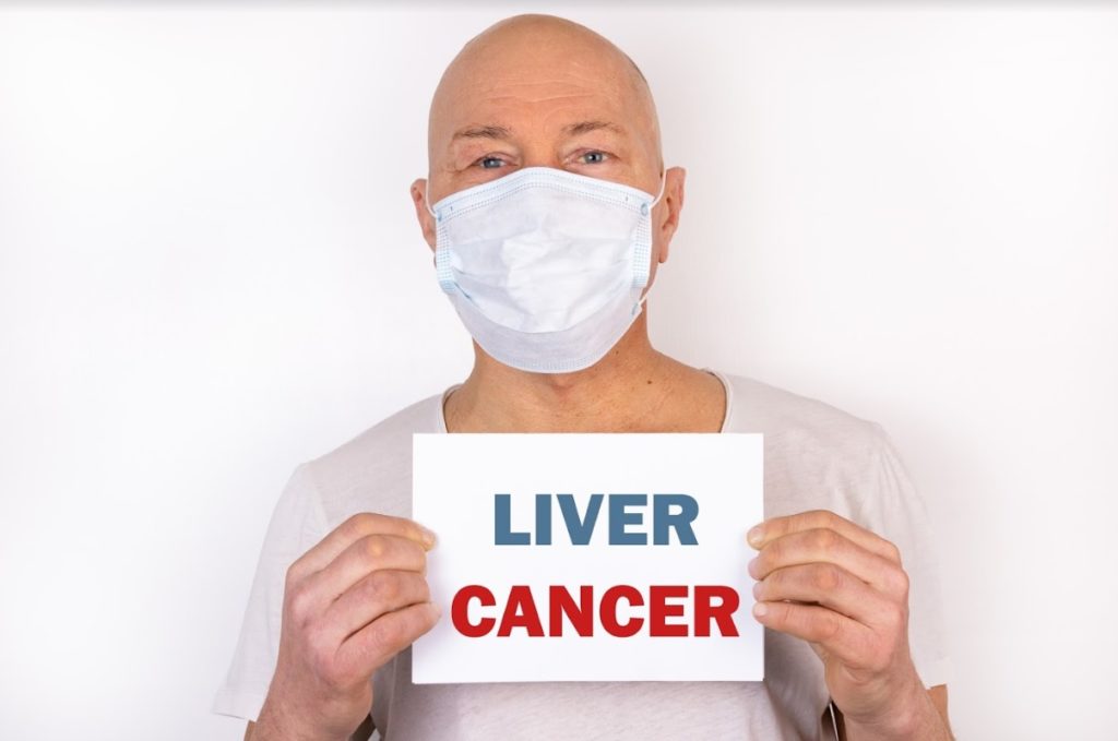 Liver cancer