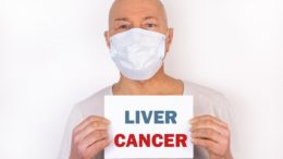 Liver cancer