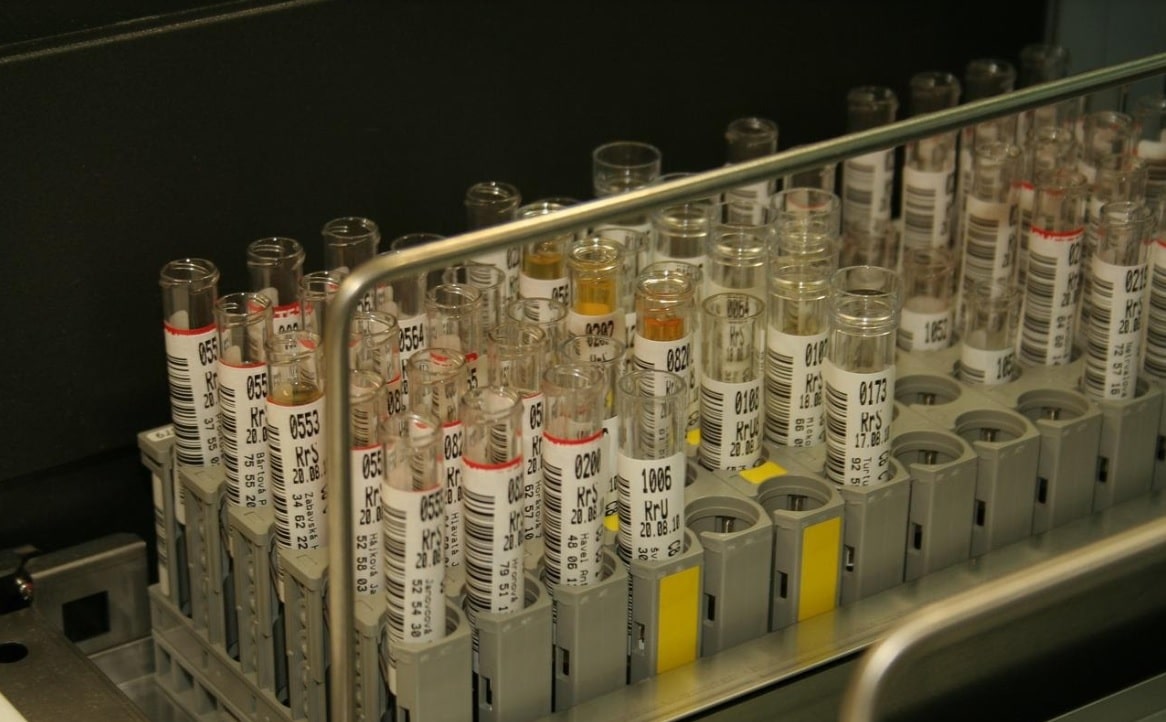 A New Artificial Urine Protocol to Better Imitate Human Urine. How?