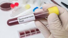 Testosterone Replacement Therapy