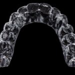 Invisalign Costs in Vancouver 2021 – A Comprehensive Guide