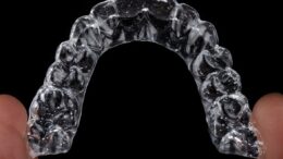 Invisalign braces