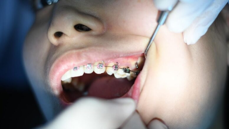 dentist child