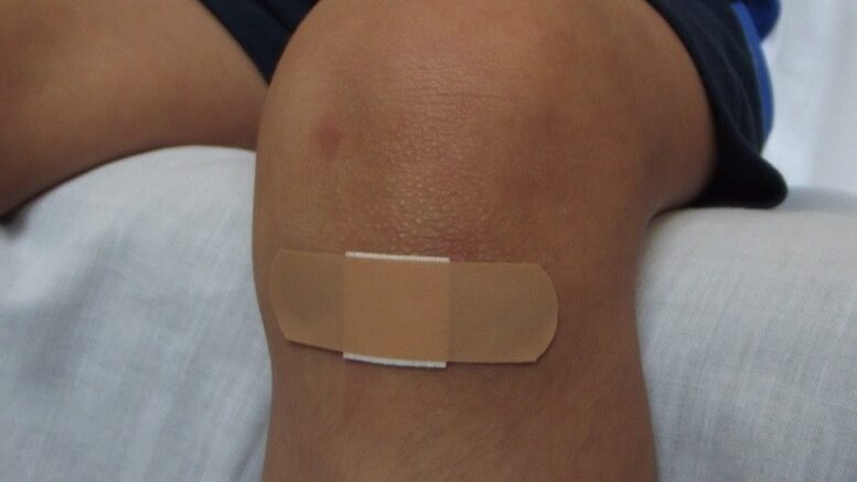 knee wound