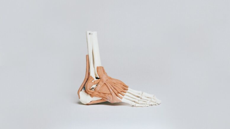 prosthetic foot