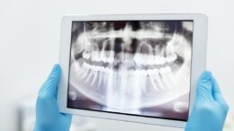dental x-ray