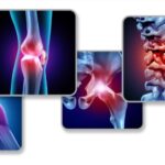 8 Natural Ways To Relieve Arthritis Pain