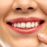 Teeth Whitening Singapore: How much does it cost?