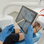 The Fundamentals of Dental Implants