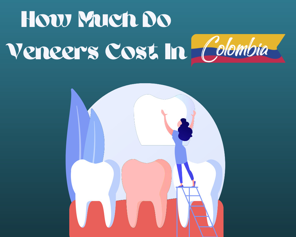 How Much Do Veneers Cost In Colombia And Why It's The Best Place To Get