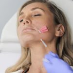 Facial Rejuvenation Techniques: A Comparison of Thread Lifts and Other Options