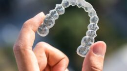 invisalign implant