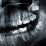 3 Ways Poor Dental Health Can Affect Your Overall Health