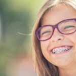 Choosing Braces Over Invisalign for Faster Teeth Alignment