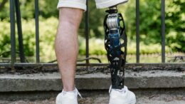 titanium prosthetics