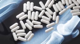 supplements for arthritis