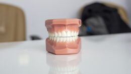 dental prosthetics