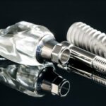 4 New Innovations In Dental Implant Technology