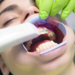 Cosmetic Dentistry Techniques to Fix Crooked Teeth