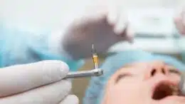 dental implant surgery