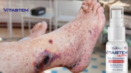 Vitastem Sponsored article