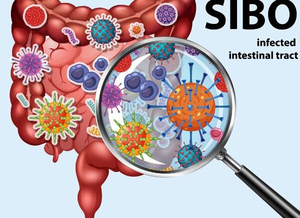 sibo intestines