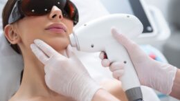 Laser hair removal